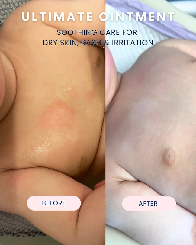 Digital photograph advertisement featuring a side-by-side comparison of a baby&