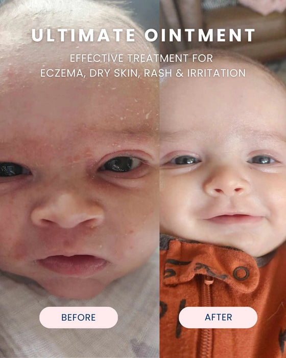 Noodle & Boo Ultimate Ointment, 3.4 oz