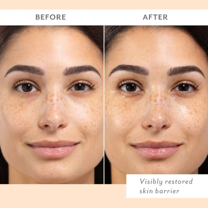 Digital photograph of a woman's facial complexion in a before and after skincare comparison featuring arched eyebrows, light brown freckles across her nose and cheeks, and a hydrated dewy glow in the after panel with the text Visibly restored skin barrier