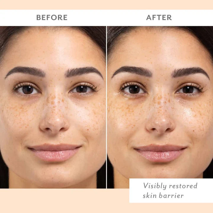 Skin Remedy Barrier -Boosting Sheet Mask - Single