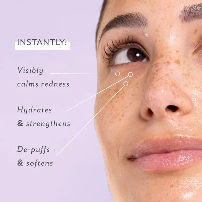 Skin Remedy Soothing Eye Gel - 5 Pack